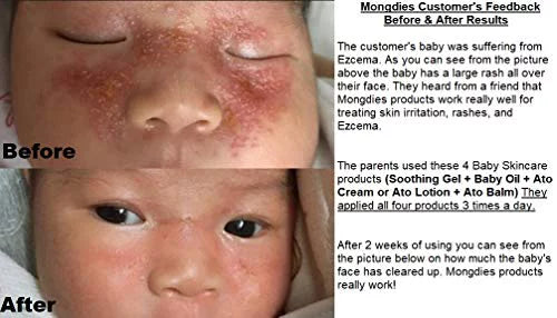 Mongdies Baby Ato Cream-Moisturizing & Hydrating solutions for sensitive and delicate skin, Excellent grade in German Derma Test, All ingredients of EWG Green Level, Natural fragrance -240ml